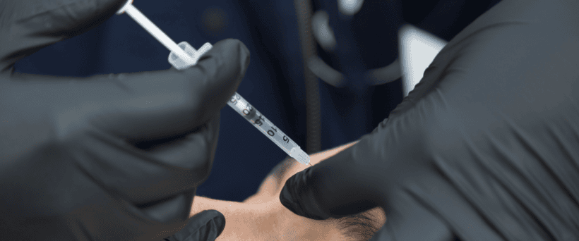HARmonyCa™ injections for facial skin